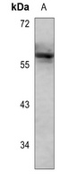 LYN (Phospho-Y508) Antibody