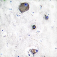 LYN (Phospho-Y508) Antibody