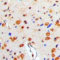 TAU (Phospho-T529) Antibody