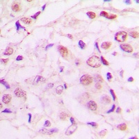 MEF2A (Phospho-T319) Antibody
