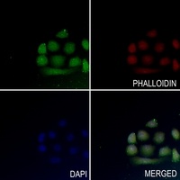 MEF2A (Phospho-T319) Antibody