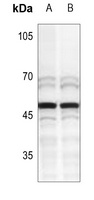 MNDA Rabbit Polyclonal Antibody