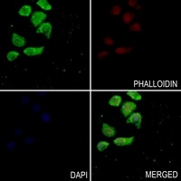 MNDA Rabbit Polyclonal Antibody