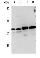 MYF6 Rabbit Polyclonal Antibody
