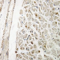 MYF6 Rabbit Polyclonal Antibody