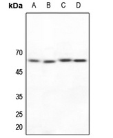 NAB2 Rabbit Polyclonal Antibody