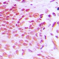 NAB2 Rabbit Polyclonal Antibody