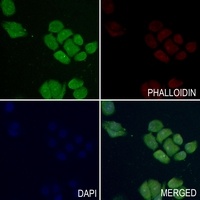 Merlin (Phospho-S518) Antibody