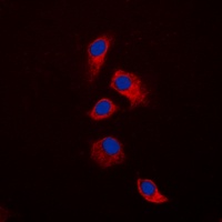 Osteoprotegerin Antibody