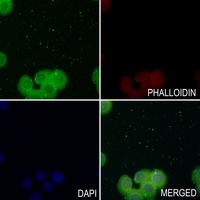 Mu Opioid Receptor Rabbit Polyclonal Antibody