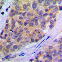 PLA2G4A (Phospho-S505) Antibody