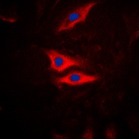 PLA2G4A (Phospho-S505) Antibody