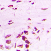 PLK1 (Phospho-T210) Antibody