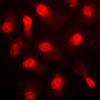 AMPK alpha 1 (Phospho-S496) Antibody