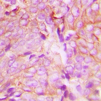 PKC delta (Phospho-Y313) Antibody