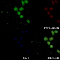 PKC delta (Phospho-Y313) Antibody