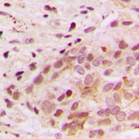 ERK3 Rabbit Polyclonal Antibody