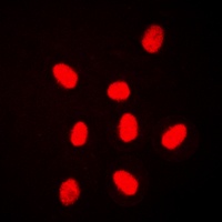 ERK3 Rabbit Polyclonal Antibody