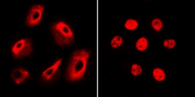 TRITC IF Detection System Kit (Mouse Anti-Goat)