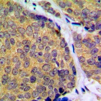 MKK2 (Phospho-T394) Antibody