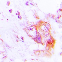 PKR (Phospho-T451) Antibody