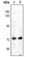 NF-kappaB p65 (Phospho-S529) Antibody