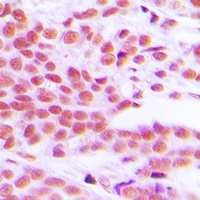 NF-kappaB p65 (Phospho-S529) Antibody