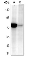 NF-kappaB p65 (Acetyl-K310) Rabbit Polyclonal Antibody