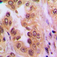 NF-kappaB p65 (Acetyl-K310) Rabbit Polyclonal Antibody