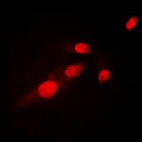 NF-kappaB p65 (Acetyl-K310) Rabbit Polyclonal Antibody