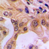 NF-kappaB p65 (Phospho-S529) Antibody