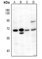 NF-kappaB p65 Rabbit Polyclonal Antibody