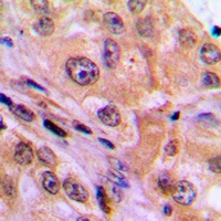 NF-kappaB p65 Rabbit Polyclonal Antibody