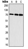 S6K1 (Phospho-T444) Antibody