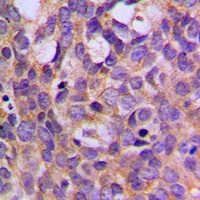 S6K1 (Phospho-T444) Antibody