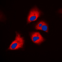 S6K1 (Phospho-T444) Antibody
