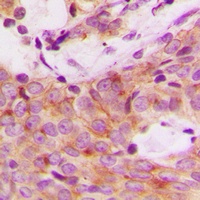 S6K1 (Phospho-S447) Antibody