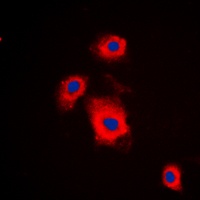 S6K1 (Phospho-S447) Antibody