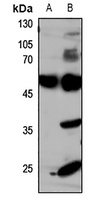 GLUT4 Antibody