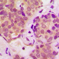 STAT6 (Phospho-Y641) Antibody