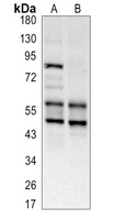 LKB1 Rabbit Polyclonal Antibody