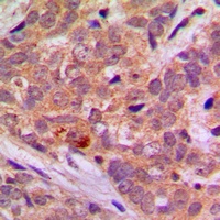 LKB1 Rabbit Polyclonal Antibody