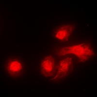 LKB1 Rabbit Polyclonal Antibody