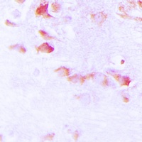Synapsin 1 (Phospho-S9) Antibody