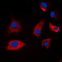 Synapsin 1 (Phospho-S9) Antibody