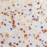 Tyrosine Hydroxylase (Phospho-S71) Antibody