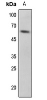 p53 (Phospho-S33) Rabbit Polyclonal Antibody