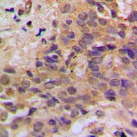 p53 (Phospho-S37) Antibody