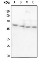 p53 Rabbit Polyclonal Antibody