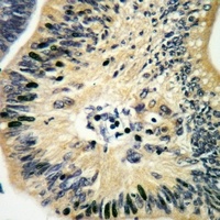 p53 Rabbit Polyclonal Antibody